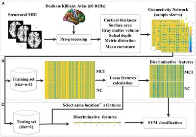Individual Morphological Brain Network Construction Based on Multivariate Euclidean Distances Between Brain Regions